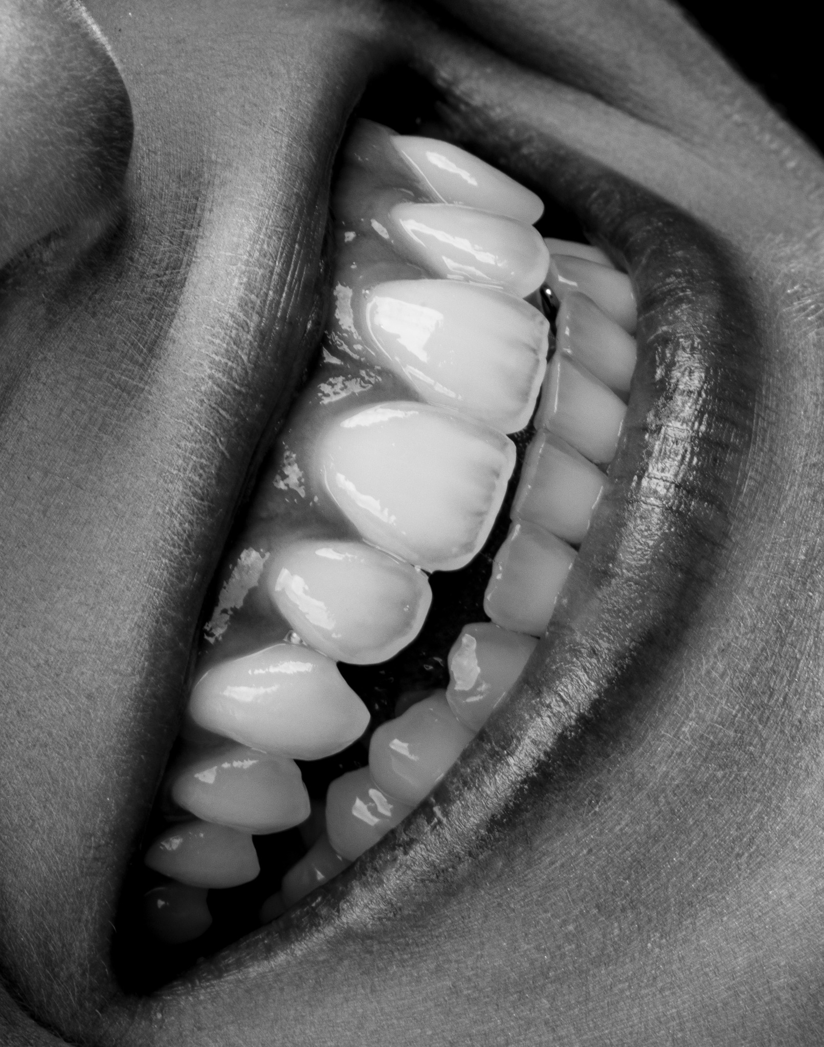 Fotografía odontológica en blanco y negro mostrando detalles de la sonrisa